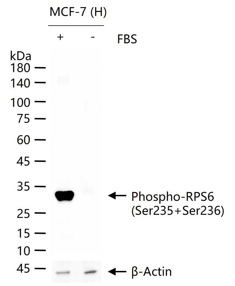 磷酸化S6核糖体蛋白重组兔单抗