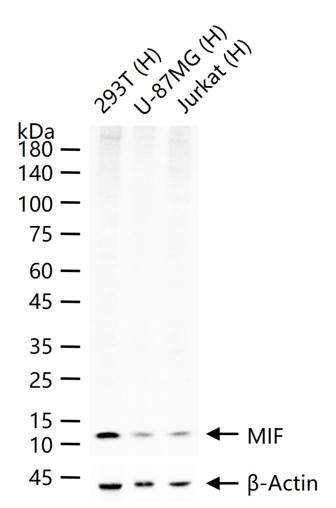 巨噬细胞移动抑制因子重组兔单抗