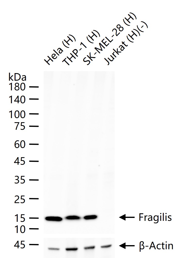 干扰素诱导跨膜蛋白3重组兔单抗