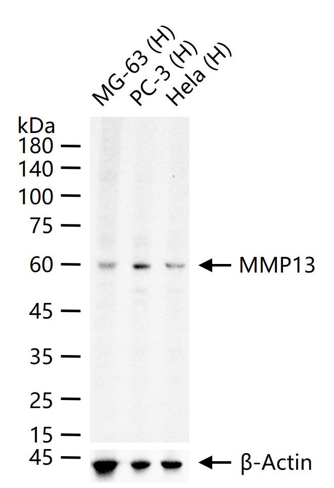 MMP13 Rabbit pAb (一抗) - WB,IHC-P,IHC-F,IF | Bioss