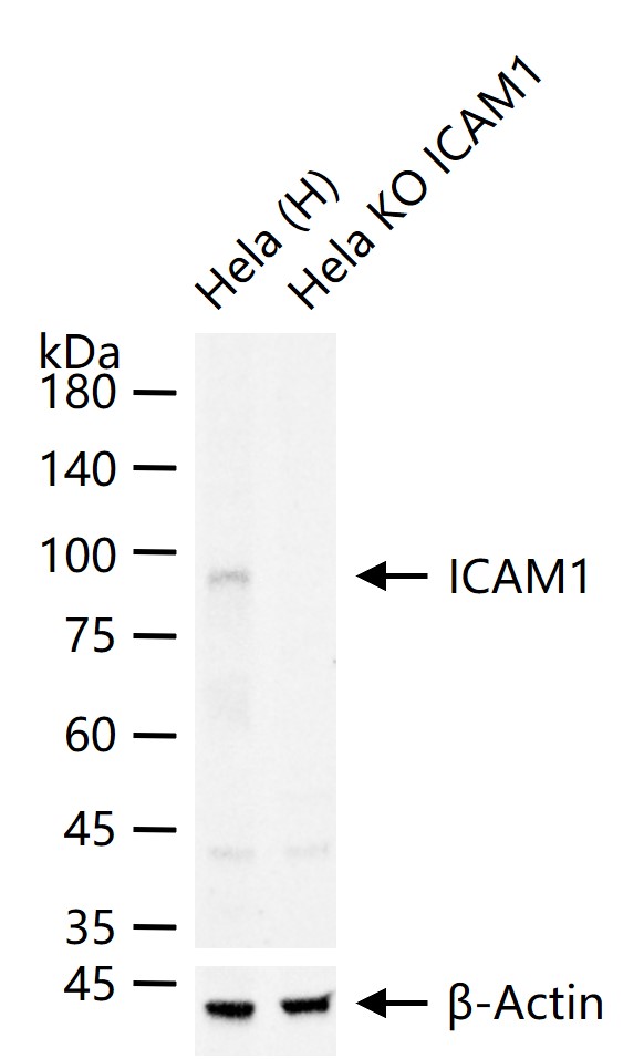 细胞间粘附分子-1(CD54)重组兔单抗