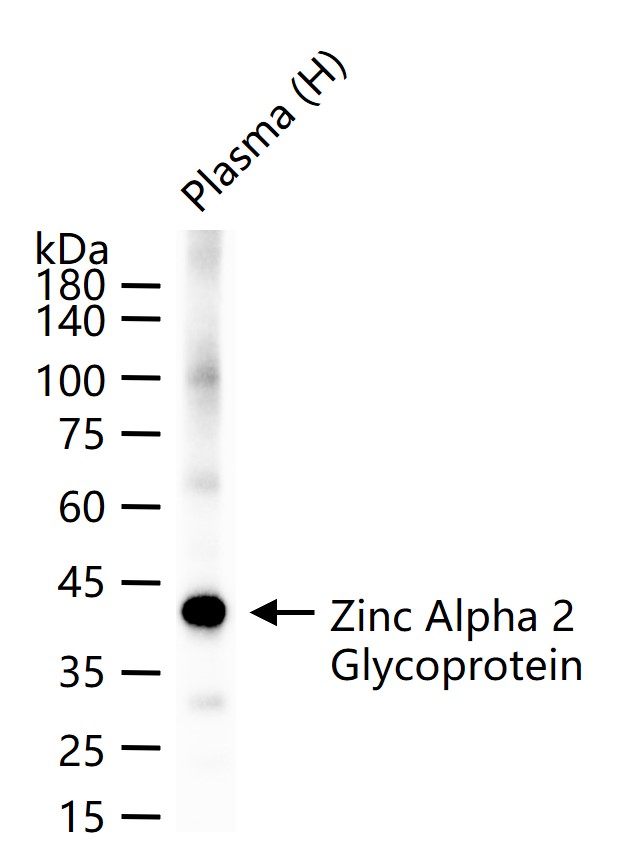 锌α2糖蛋白重组兔单抗