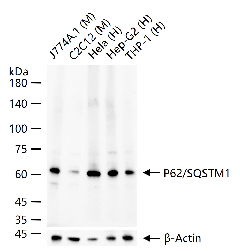 SQSTM1/p62 Rabbit pAb (一抗) - WB,IHC-P,IHC-F,IF,Flow-Cyt,ICC/IF,ELISA | Bioss