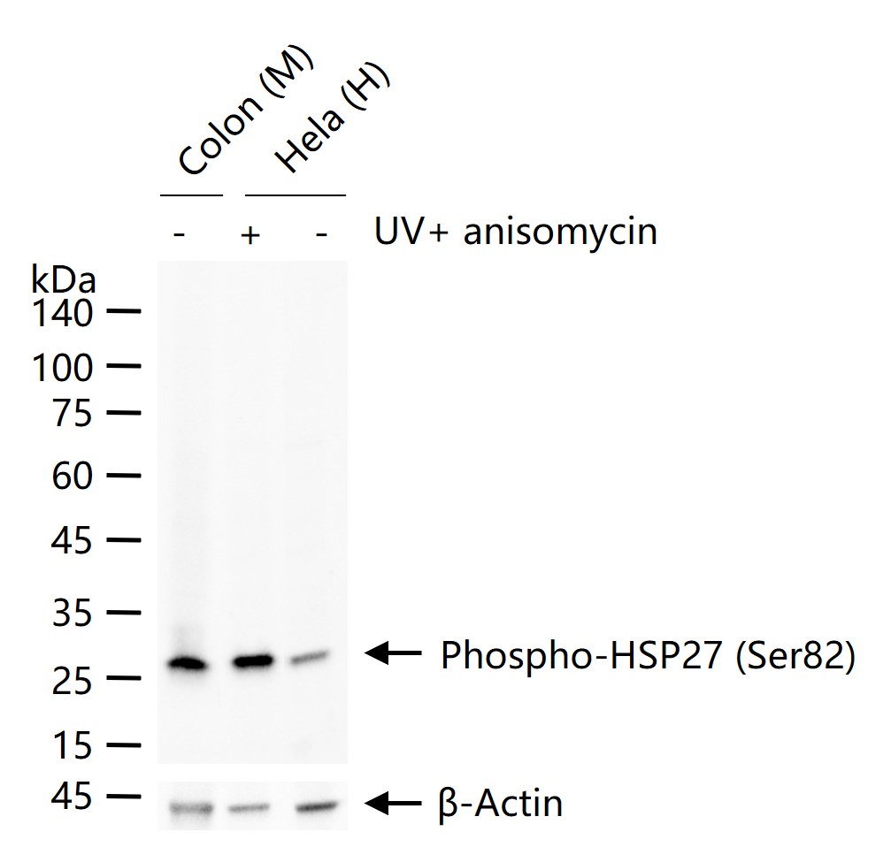 phospho-HSP27 (Ser82) Recombinant Rabbit mAb (一抗) - WB,Flow-Cyt | Bioss