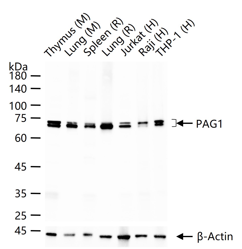 PAG1 Recombinant Rabbit mAb (一抗) - WB,IHC-P,IHC-F,IF,Flow-Cyt,ICC/IF,IP | Bioss