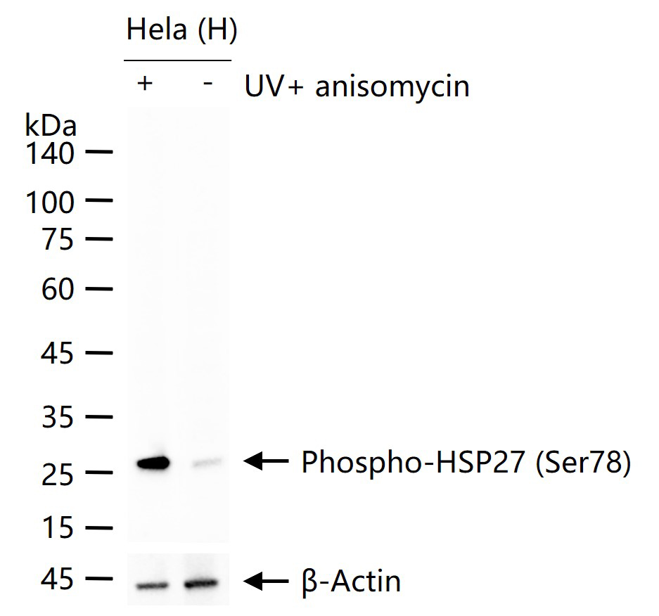 phospho-HSP27 (Ser78) Recombinant Rabbit mAb (一抗) - WB,IHC-P,IHC-F,IF,Flow-Cyt,ICC/IF,ELISA | Bioss