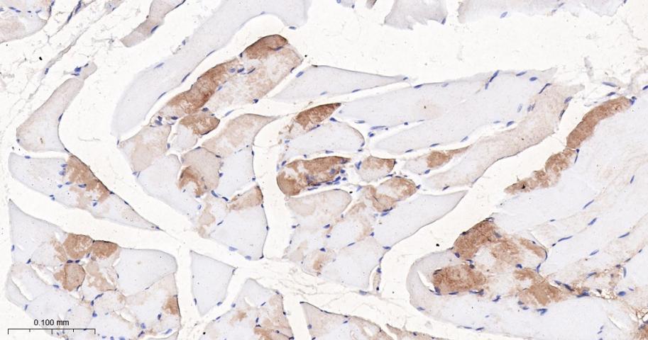 心型脂肪酸结合蛋白/脂肪酸结合蛋白3重组兔单抗
