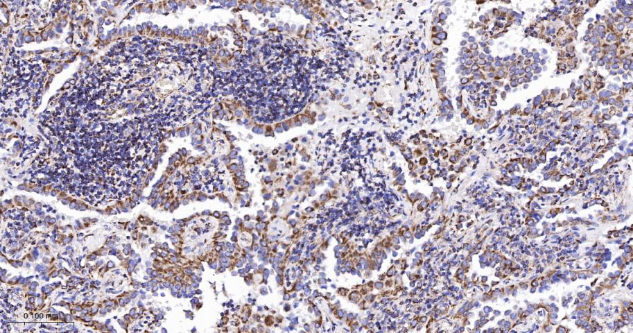 TSPO蛋白重组兔单抗