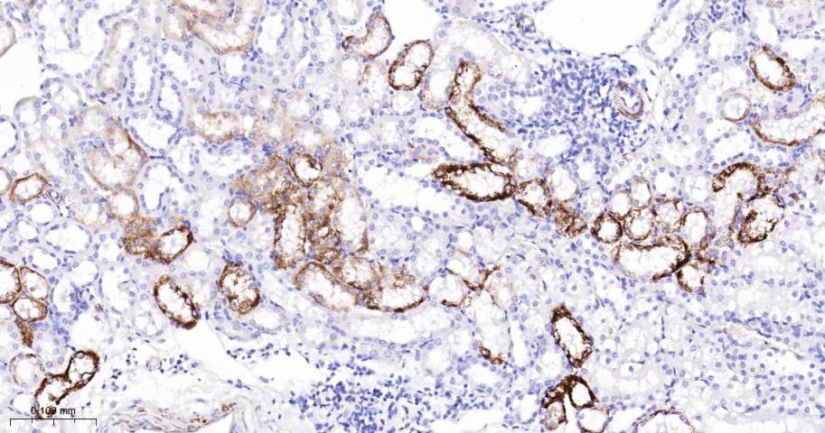 三羟基三甲基辅酶A合成酶2重组兔单抗