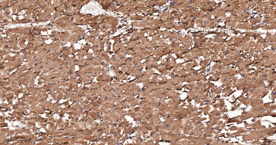 心型脂肪酸结合蛋白/脂肪酸结合蛋白3重组兔单抗