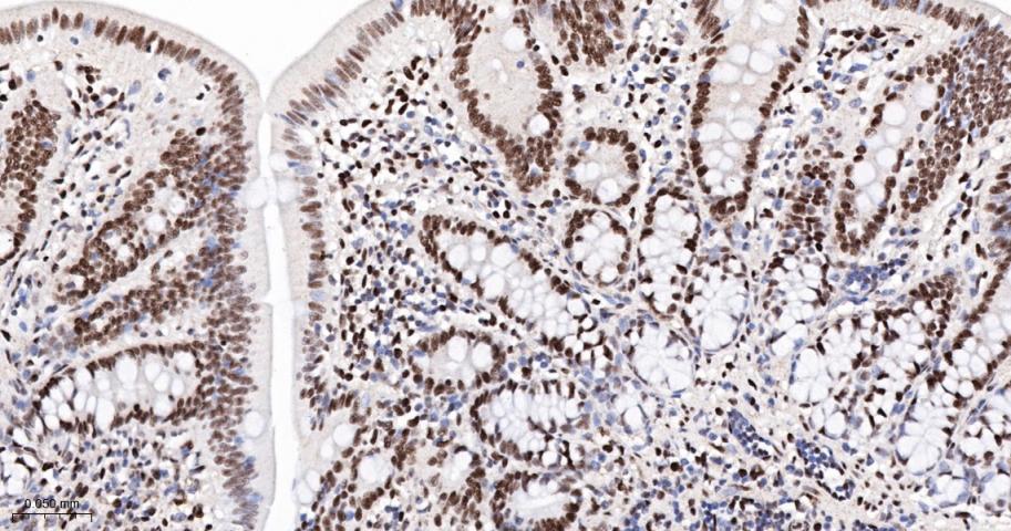 转录中介因子Tif1β重组兔单抗