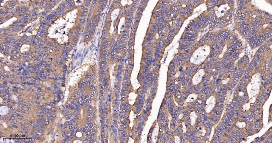 脂肪酸去饱和酶1重组兔单抗