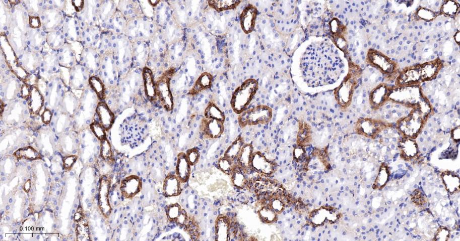 脂阀结构蛋白1重组兔单抗