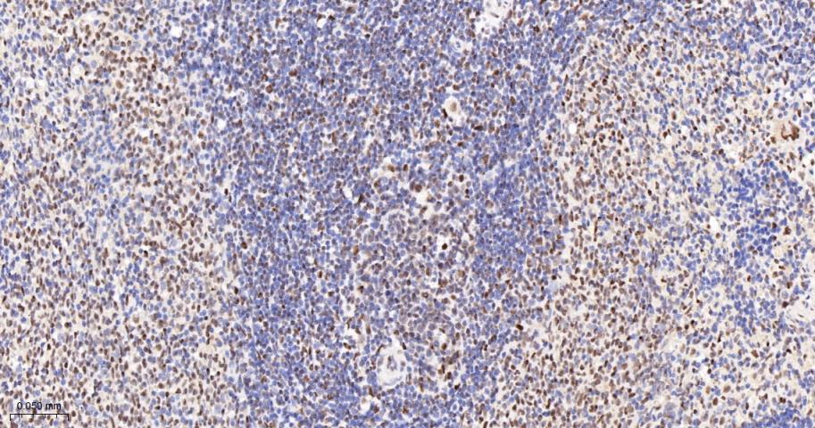 转录中介因子Tif1β重组兔单抗