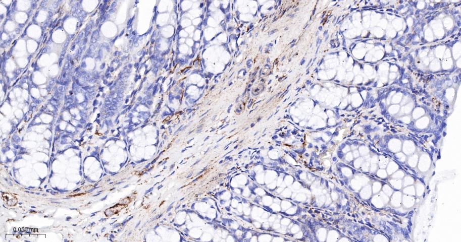 脂阀结构蛋白1重组兔单抗