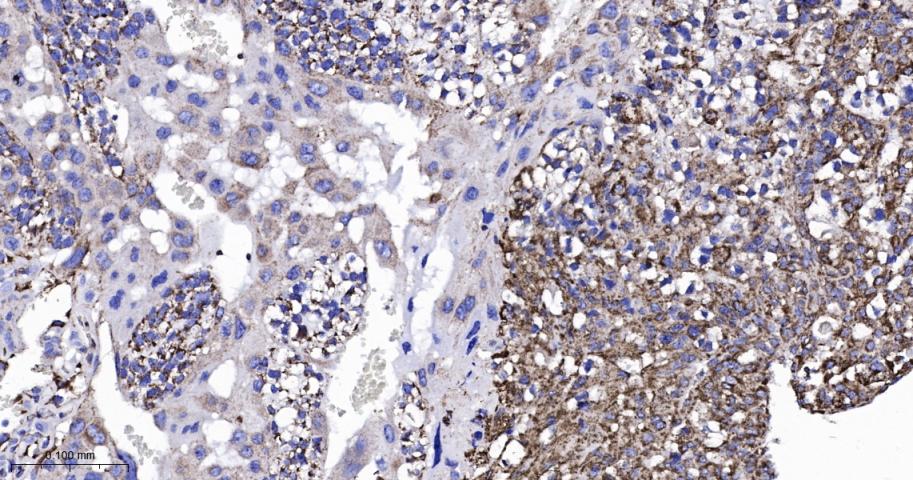 TSPO蛋白重组兔单抗