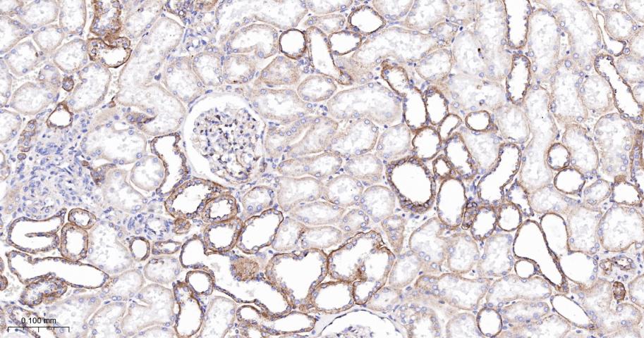 脂阀结构蛋白1重组兔单抗