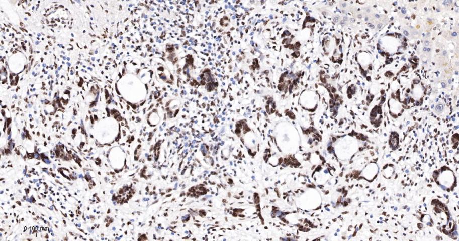转录中介因子Tif1β重组兔单抗