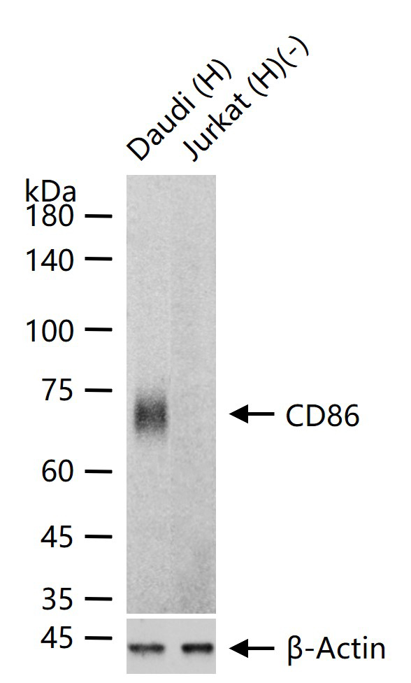 CD86重组兔单抗