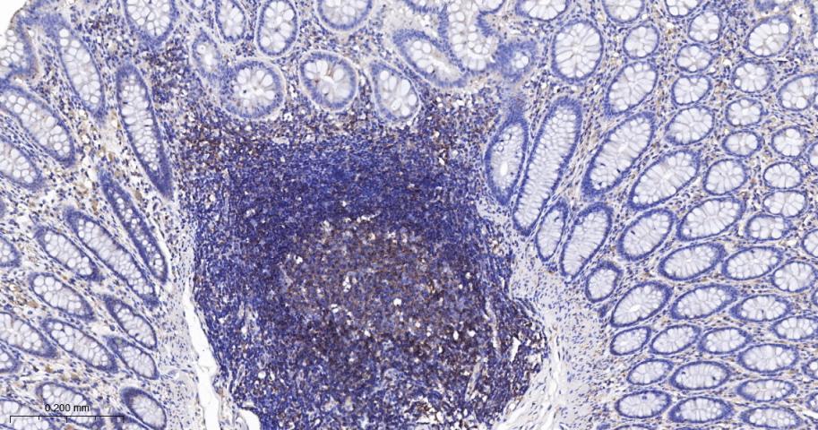 脂阀结构蛋白1重组兔单抗