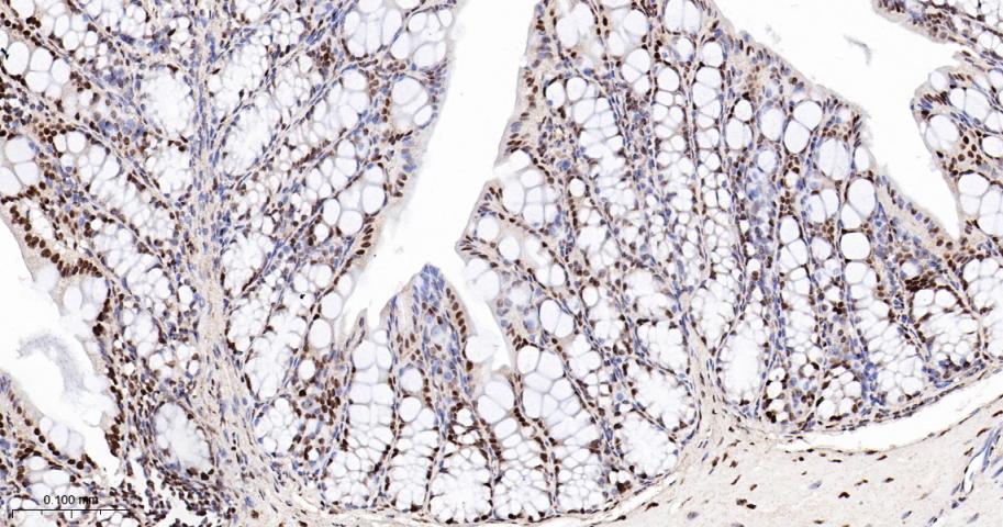 转录中介因子Tif1β重组兔单抗
