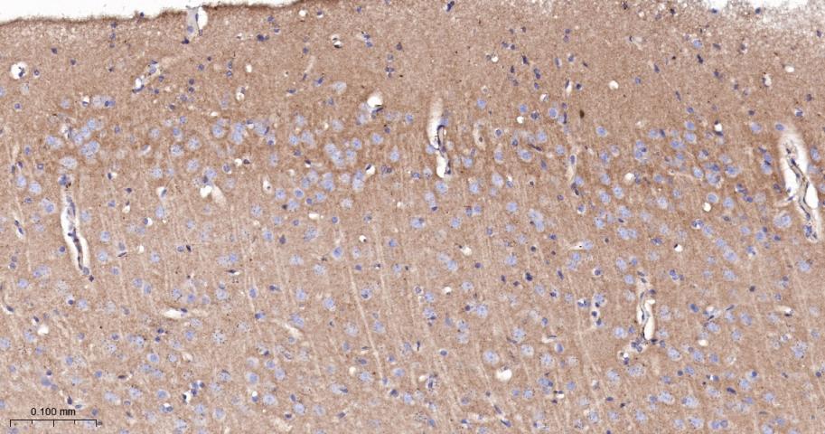 脂阀结构蛋白1重组兔单抗