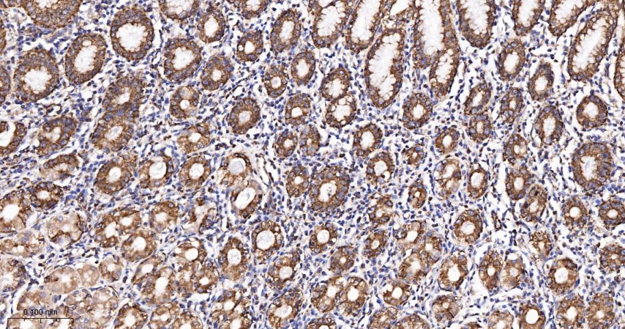 TSPO蛋白重组兔单抗
