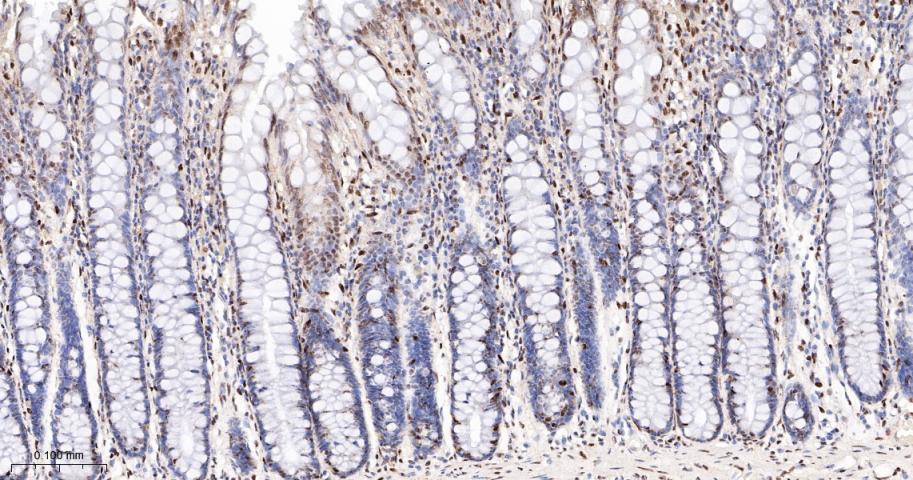 转录中介因子Tif1β重组兔单抗