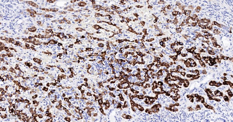 三羟基三甲基辅酶A合成酶2重组兔单抗
