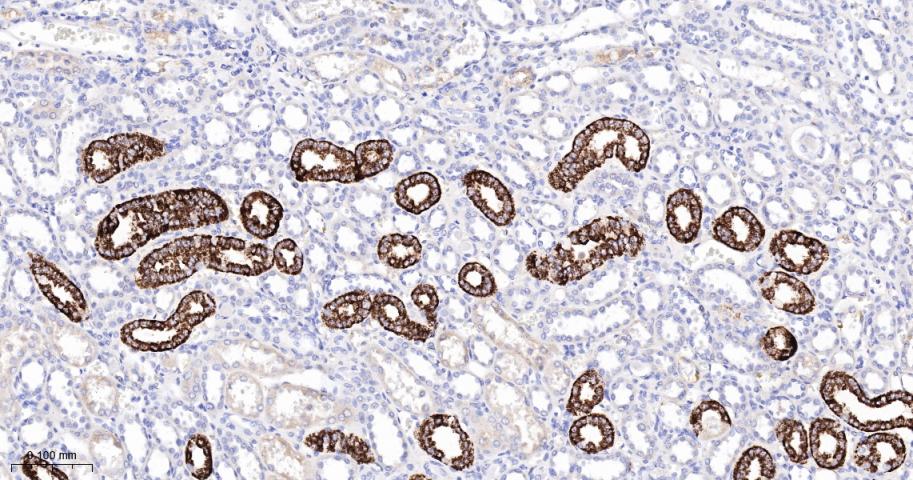 三羟基三甲基辅酶A合成酶2重组兔单抗