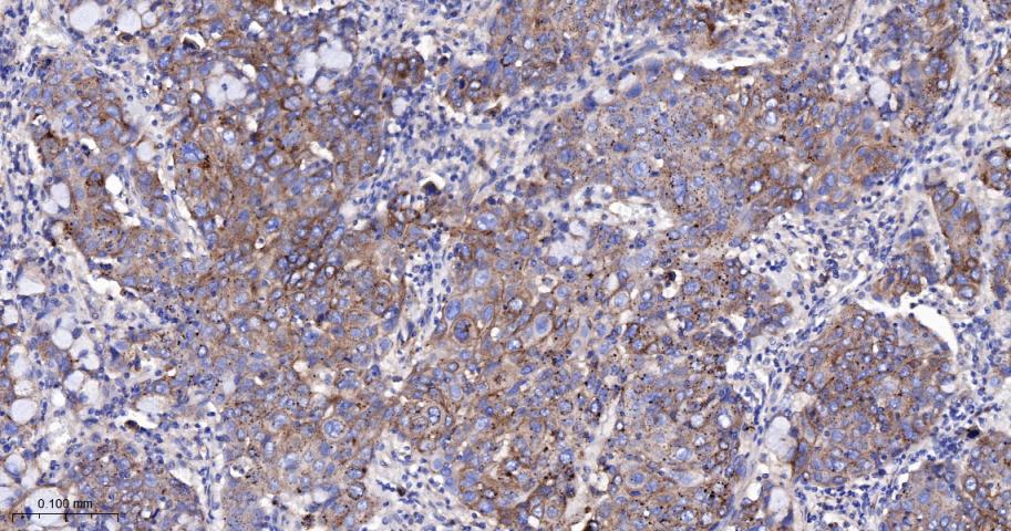 脂阀结构蛋白1重组兔单抗