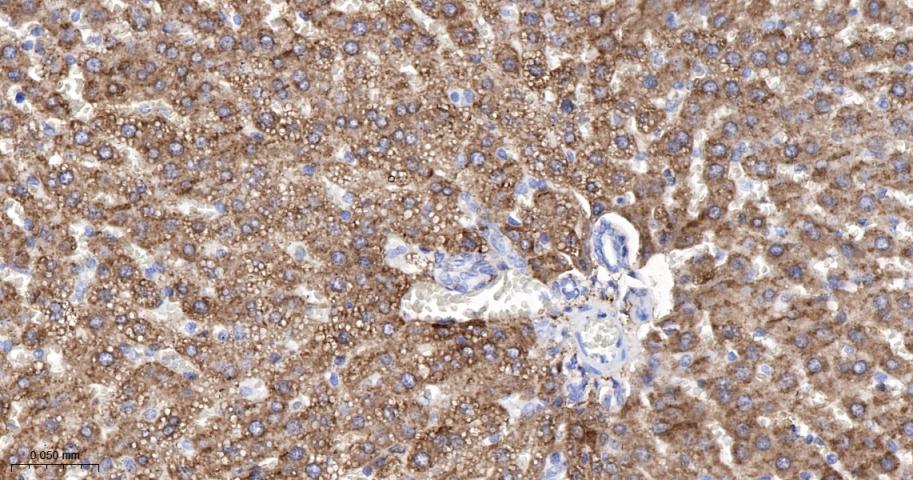 三羟基三甲基辅酶A合成酶2重组兔单抗