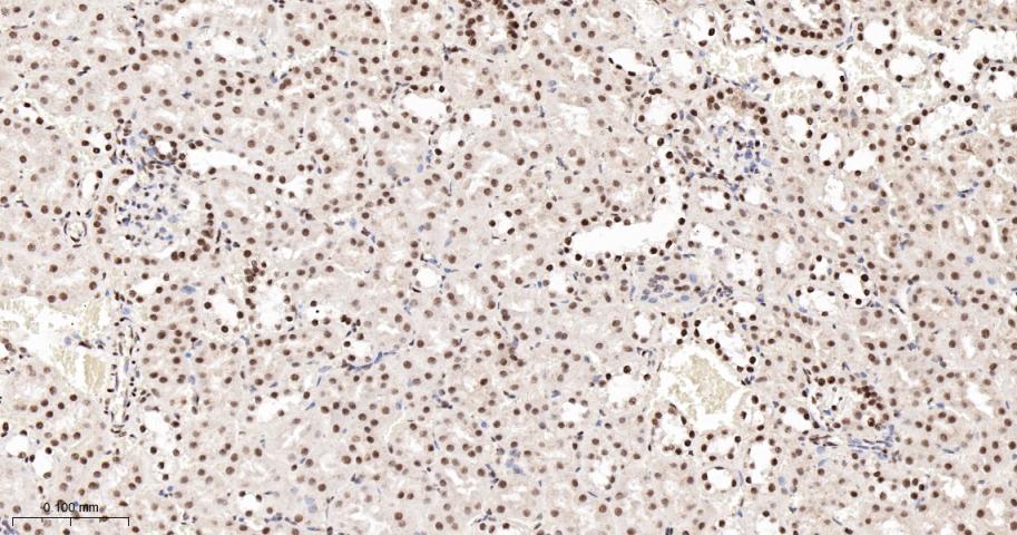 转录中介因子Tif1β重组兔单抗