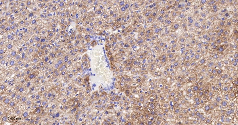 三羟基三甲基辅酶A合成酶2重组兔单抗