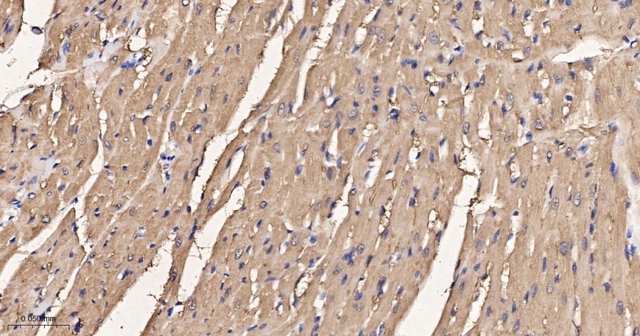 心型脂肪酸结合蛋白/脂肪酸结合蛋白3重组兔单抗
