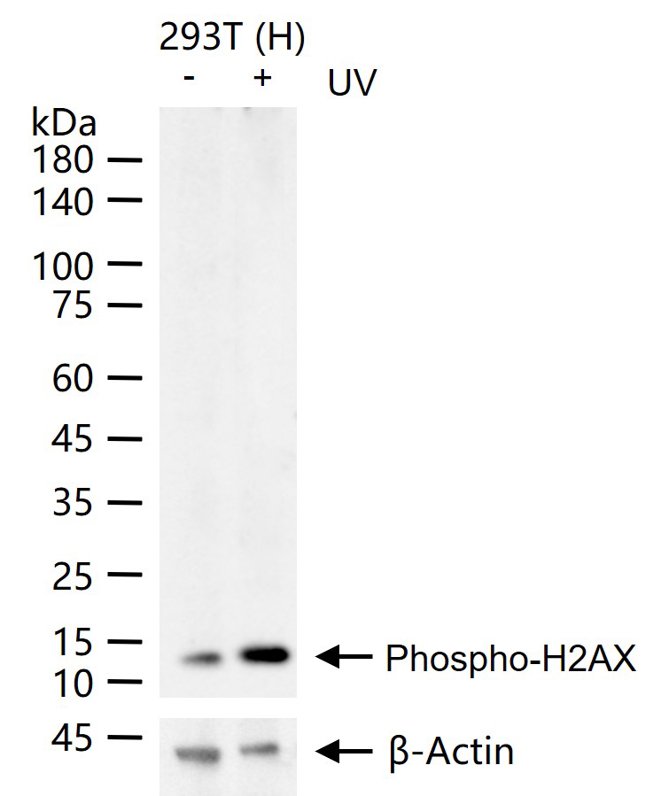磷酸化组蛋白H2AX重组兔单抗