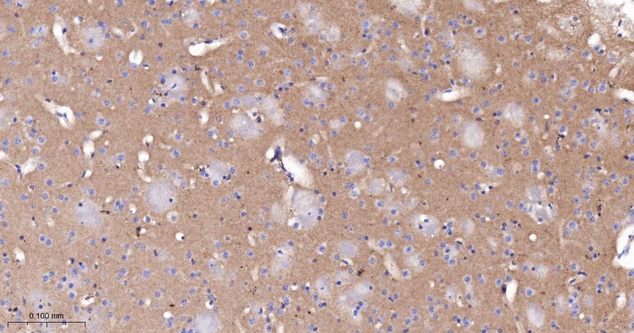 脂阀结构蛋白1重组兔单抗