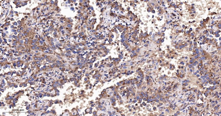 脂肪酸去饱和酶1重组兔单抗