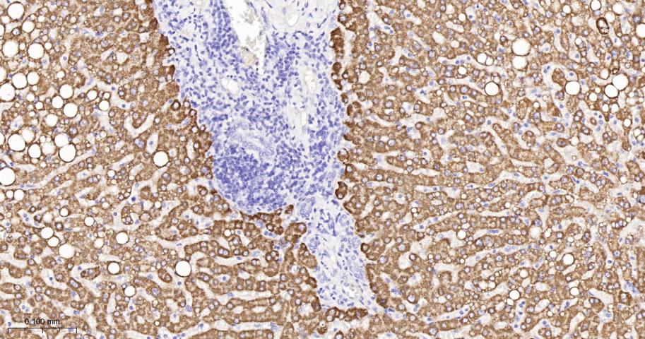 三羟基三甲基辅酶A合成酶2重组兔单抗