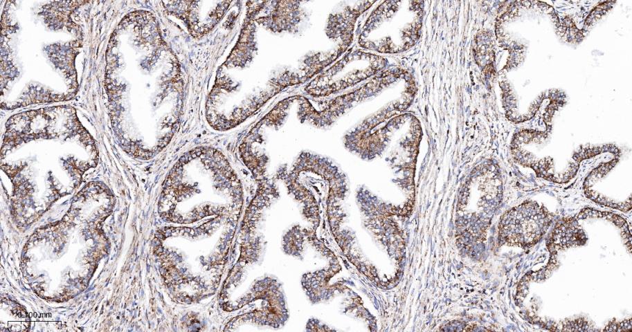 TSPO蛋白重组兔单抗
