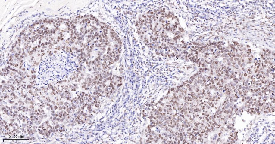 转录中介因子Tif1β重组兔单抗