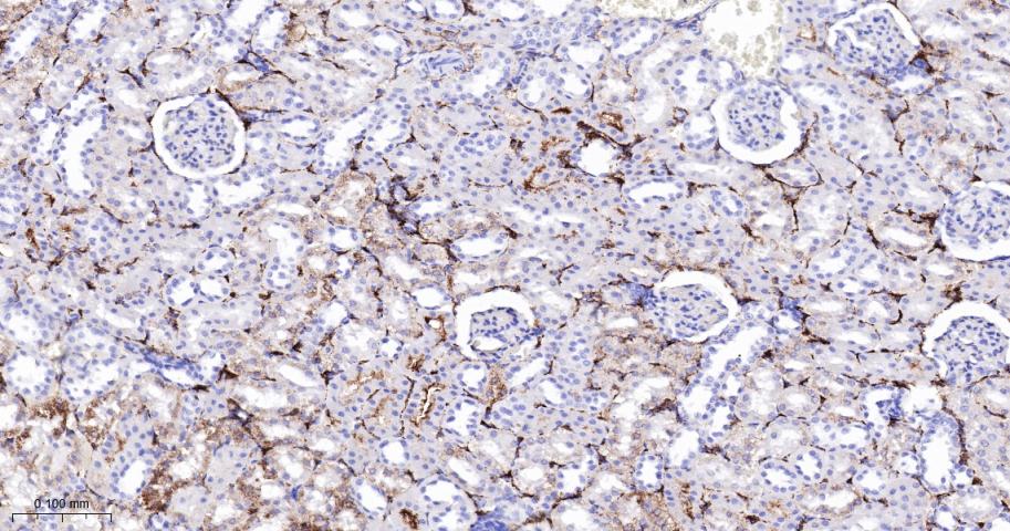 三羟基三甲基辅酶A合成酶2重组兔单抗