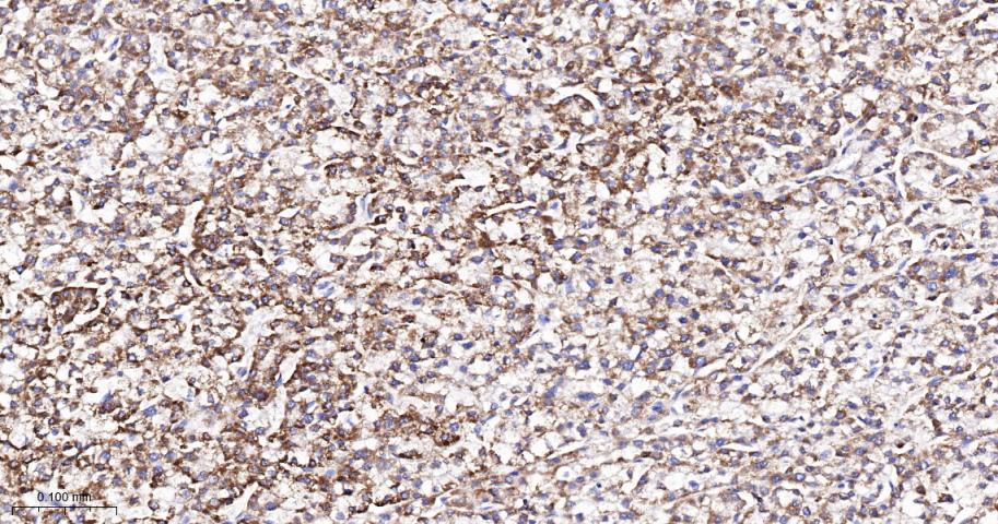 TSPO蛋白重组兔单抗