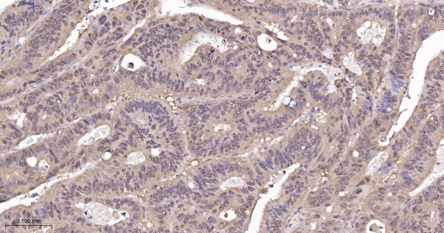 转录因子RelB蛋白重组兔单抗