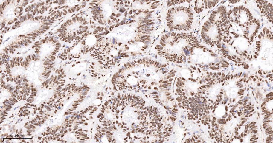 转录中介因子Tif1β重组兔单抗