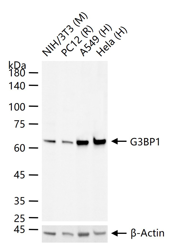 Ras GTP酶活化蛋白结合蛋白1重组兔单抗
