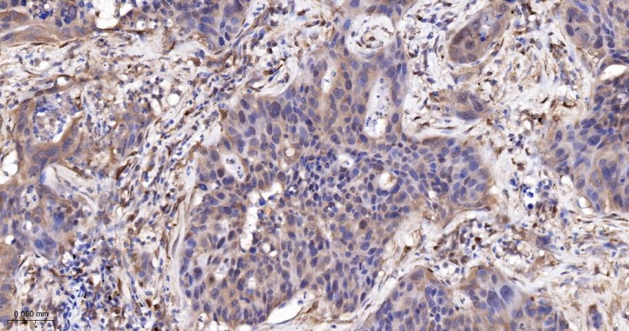 转录因子RelB蛋白重组兔单抗
