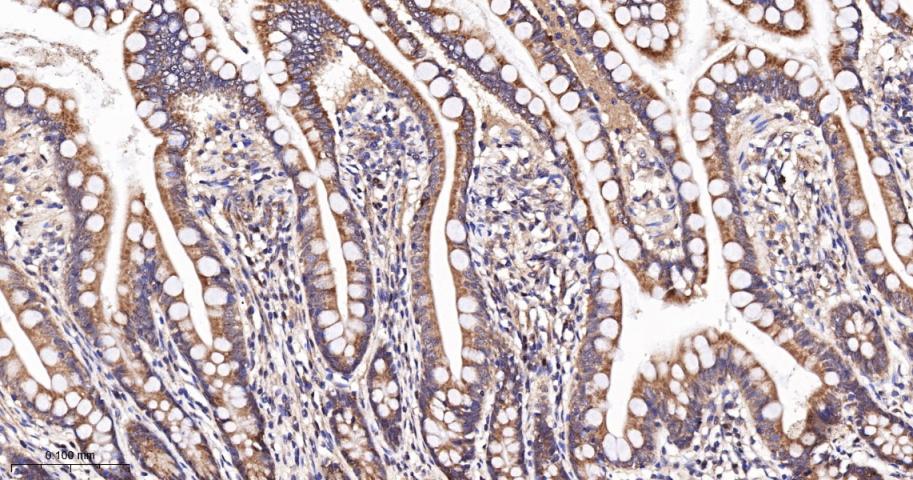 过氧化物酶体生物合成因子11B重组兔单抗