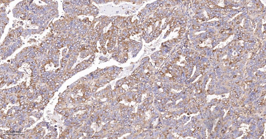 脂肪酸去饱和酶1重组兔单抗