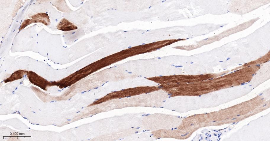 心型脂肪酸结合蛋白/脂肪酸结合蛋白3重组兔单抗